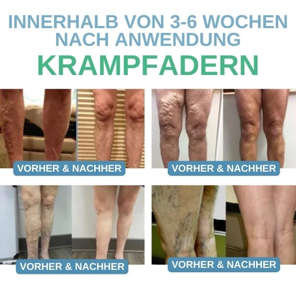 PEARLMOON™ Socken