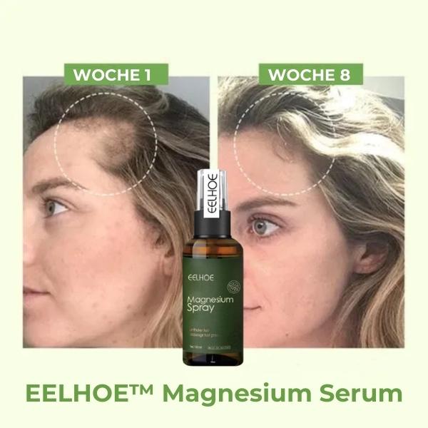 EELHOE™ Magnesium Serum