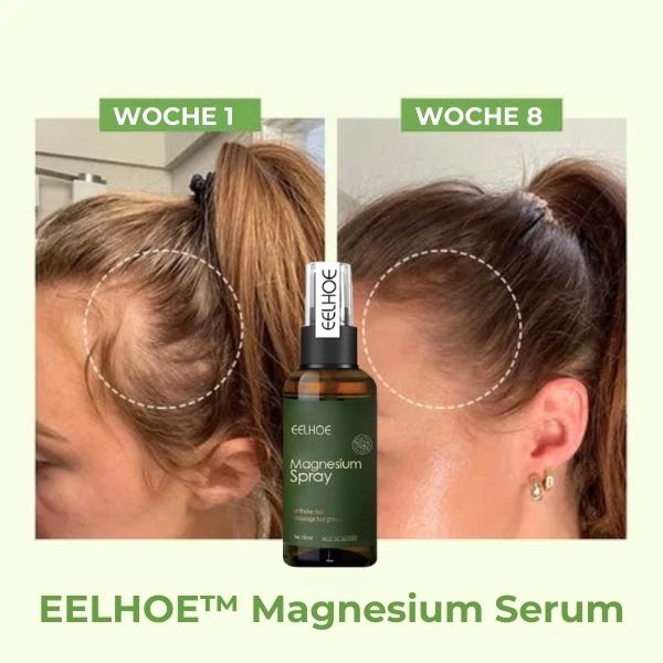 EELHOE™ Magnesium Serum