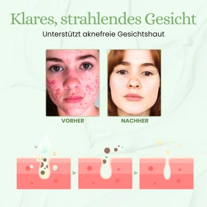 Ceoerty™ Hautbehandlung