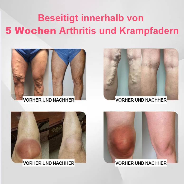 🌹🌹Made in Germany - TOMALINE MAGNETIC DETOXIFYING BODY SHAPING Strümpfe