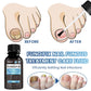 Biancat™ FungiFix Nail Fungus Treatment Care Fluid