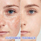 Biancat™ Flawless Radiance Blemish Cream