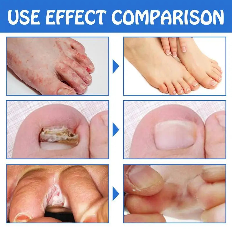 Breathable AntiFungi MicroShield Socks Comfortable Foot Support Ankle Compression Socks Achilles Tendonitis Brace For Women Men