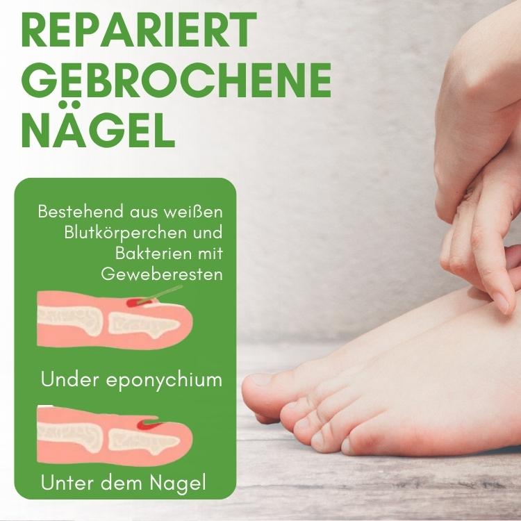 Efero™ Nagelwachstum