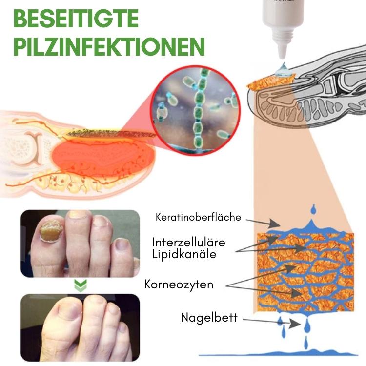 Efero™ Nagelwachstum